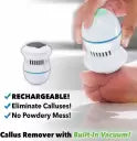 Vishou Pedi Vac for foot Callus Remover & Hard Cracked Skin Massager